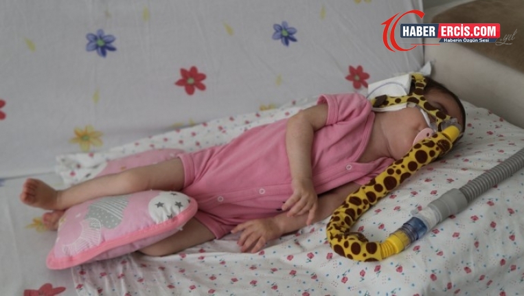 SMA hastası Zümra bebek dayanışma bekliyor